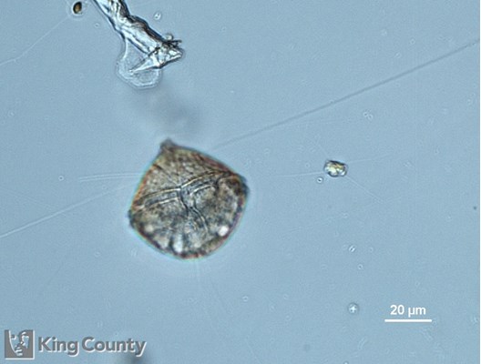 Photo of Protoperidinium sp.